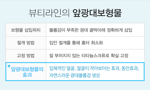 뷰티라인성형외과's 앞광대보형물:보형물 삽입위치-볼륨감이 부족한 광대 골막아래 정확하게 삽입,절개 방법-입안 절개를 통해 흉터 최소화,고정 방법-잘 부러지지 않는 티타늄스크류로 확실 고정,앞광대보형물의 효과-입체적인 얼굴, 얼굴이 작아보이는 효과, 동안효과, 자연스러운 광대볼륨감 생성 